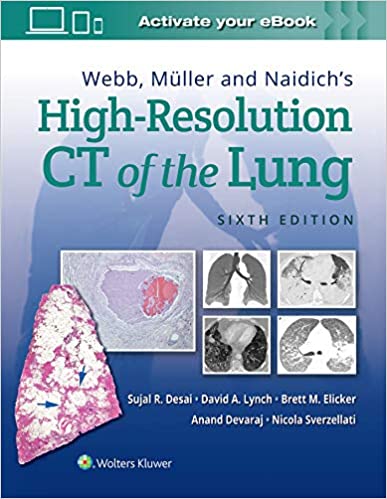 (eBook HTML)Webb, Müller and Naidichs High-Resolution CT of the Lung 6th edition by Sujal Desai , Anand Devaraj 