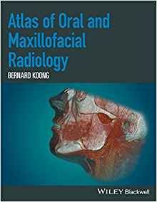 (eBook PDF)Atlas of Oral and Maxillofacial Radiology by Bernard Koong 