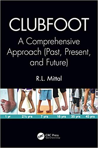 (eBook PDF)Clubfoot A Comprehensive Approach by R. L. Mittal 