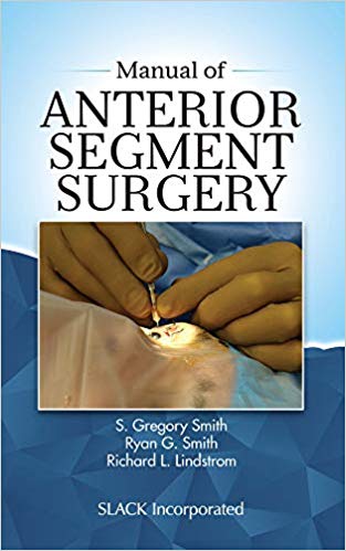 (eBook PDF)Manual of Anterior Segment Surgery by S Gregory Smith MD , Ryan G Smith MD , Richard Lindstrom MD 