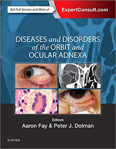 (eBook PDF)Diseases and Disorders of the Orbit and Ocular Adnexa, 1e 1st Edition by Aaron Fay MD , Peter J Dolman MD FRCSC 