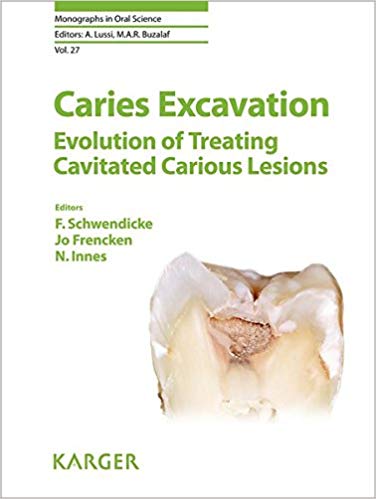 (eBook PDF)Caries Excavation Evolution of Treating Cavitated Carious Lesion by F. Schwendicke , J. Frencken , N. Innes , A. Lussi (Series Editor), M.A.R. Buzalaf (Series Editor)