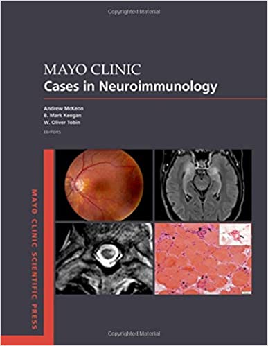 (eBook PDF)Mayo Clinic Cases in Neuroimmunology by Andrew McKeon , B. Mark Keegan , W. Oliver Tobin 