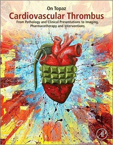 (eBook PDF)Cardiovascular Thrombus: From Pathology and Clinical Presentations to Imaging, Pharmacotherapy and Interventions by On Topaz 