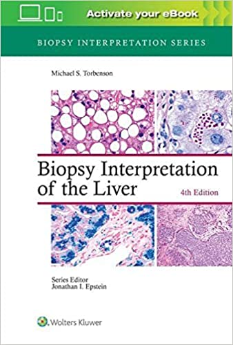 (eBook EPUB)Biopsy Interpretation of the Liver 4th Edition by Michael Torbenson MD