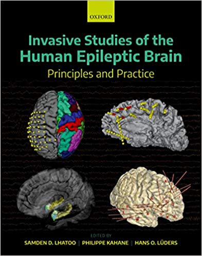 (eBook PDF)Invasive Studies of the Human Epileptic Brain: Principles and Practice by Samden D. Lhatoo , Philippe Kahane , Hans O. Luders 