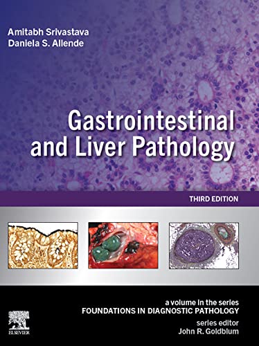 (eBook PDF)Gastrointestinal and Liver Pathology: A Volume in the Series: Foundations in Diagnostic Pathology 3rd Edition, by Amitabh Srivastava,Daniela S. Allende