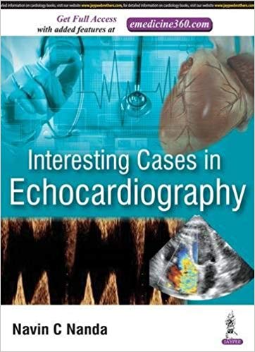 (eBook PDF)Interesting Cases in Echocardiography by Navin C. Nanda 
