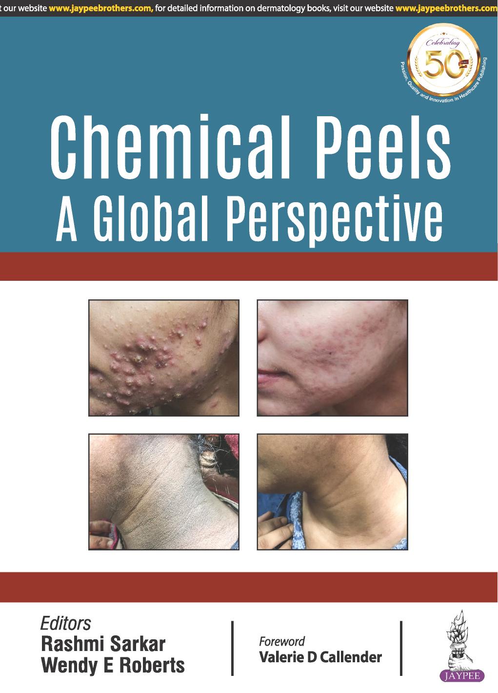 (eBook PDF)Chemical Peels: A Global Perspective 1st Edition by Rashmi Sarkar  , Wendy E Roberts , Sneha Ghunawat , Ishad Aggarwal , Zubin K Mandlewala 