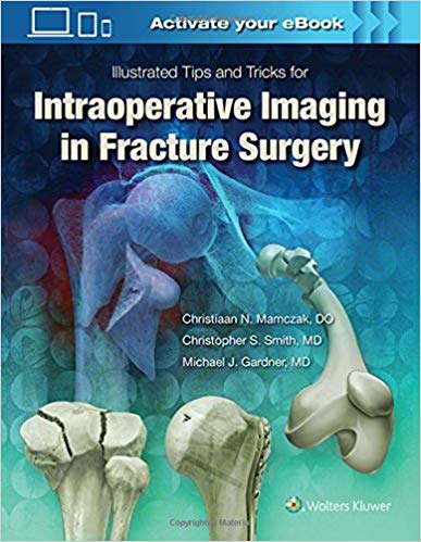 (eBook PDF)Illustrated Tips and Tricks for Intraoperative Imaging in Fracture Surgery by Michael J. Gardner MD 