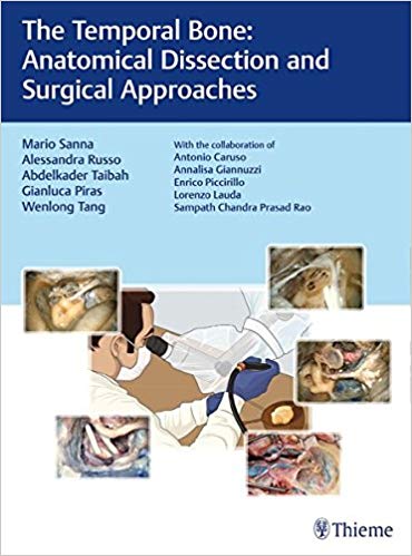 (eBook PDF)The Temporal Bone: Anatomical Dissection and Surgical Approaches by Mario Sanna , Alessandra Russo , Abdelkader Taibah , Gianluca Piras , Wenlong Tang 