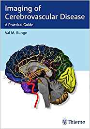 (eBook PDF)Imaging of Cerebrovascular Disease by Val M. Runge 