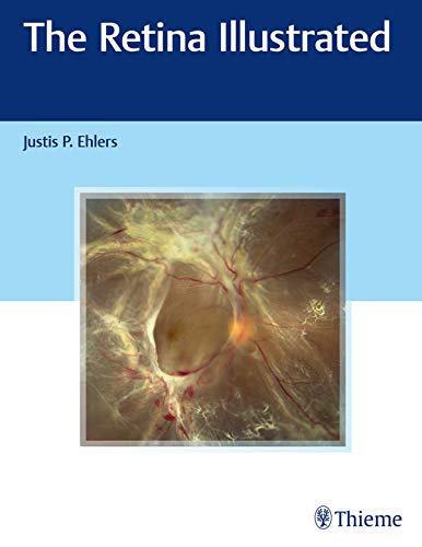 (eBook PDF)The Retina Illustrated by Justis P. Ehlers 