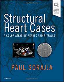 (eBook PDF)Structural Heart Cases: A Color Atlas of Pearls and Pitfalls, 1e 1st Edition by Paul Sorajja MD , Wesley A Pedersen MD , John R Lesser MD ,