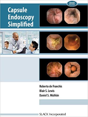 (eBook PDF)Capsule Endoscopy Simplified by Roberto DeFranchis MD , Blair S. Lewis MD , Daniel S. Mishkin MD CM 