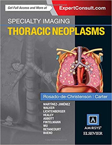 (eBook PDF)Specialty Imaging - Thoracic Neoplasms, 1e by Melissa L. Rosado-de-Christenson MD FACR , Brett W. Carter MD 