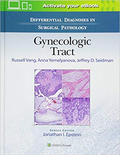 (eBook PDF)Differential Diagnoses in Surgical Pathology - Gynecologic Tract by Russell Vang MD , Anna Yemelyanova MD , Jeffrey D. Seidman MD 