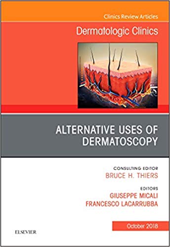 (eBook PDF)Alternative Uses of Dermatoscopy by Giuseppe Micali , Francesco Lacarrubba 
