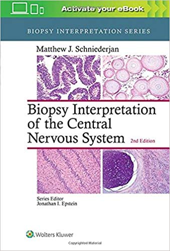 (eBook PDF)Biopsy Interpretation of the Central Nervous System Second Edition by Matthew J. Schniederjan MD 