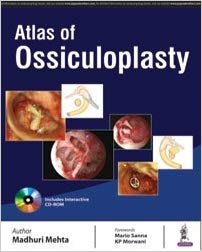 (eBook PDF)Atlas of Ossiculoplasty by Madhuri Mehta 