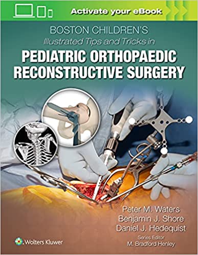 (eBook PDF)Boston Children s Illustrated Tips and Tricks in Pediatric Orthopaedic Reconstructive Surgery by Peter M Waters MD