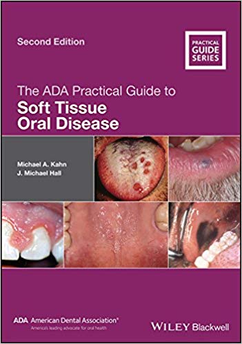 (eBook PDF)The ADA Practical Guide to Soft Tissue Oral Disease