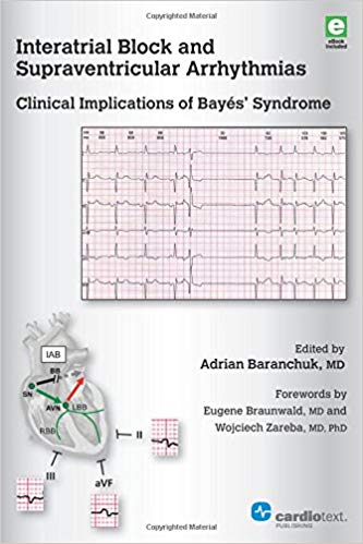 (eBook PDF)Interatrial Block and Supraventricular Arrhythmias by Adrian Baranchuk