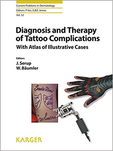 (eBook PDF)Diagnosis and Therapy of Tattoo Complications by J. Serup , W. Bäumler , P. Itin (Series Editor), G.B.E. Jemec (Series Editor)