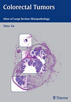 (eBook PDF)Colorectal Tumors Atlas of Large Section Histopathology, 1e  by Tibor Tot 