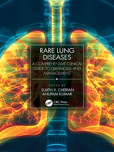 (eBook PDF)Rare Lung Diseases A Comprehensive Clinical Guide to Diagnosis and Management by Sujith V. Cherian,Anupam Kumar