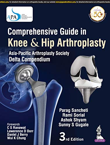 (eBook PDF)Comprehensive Guide In Knee & Hip Arthroplasty by Parag Sancheti