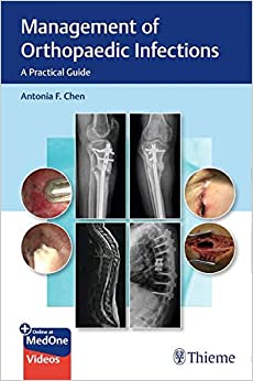 (eBook PDF)Management of Orthopaedic Infections PDF+EPUB by Antonia Chen 