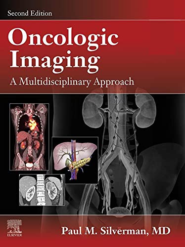 (eBook PDF)Oncologic Imaging: A Multidisciplinary Approach, Second Edition by Paul M. Silverman 