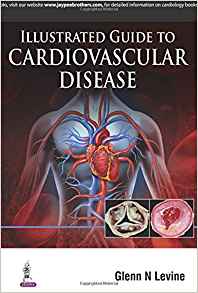 (eBook PDF)Illustrated Guide to Cardiovascular Disease by Glenn N., M.D. Levine 