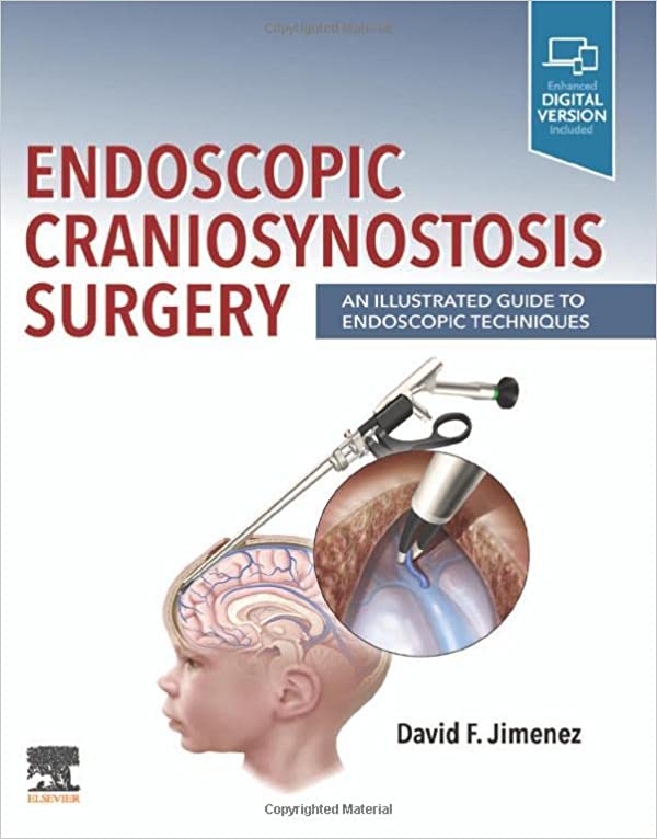 (eBook PDF)Endoscopic Craniosynostosis Surgery: An Illustrated Guide to Endoscopic Techniques 1st Edition by David F. Jimenez 