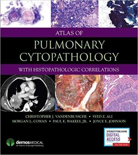 (eBook PDF)Atlas of Pulmonary Cytopathology With Histopathologic Correlation by Christopher J. VandenBussche MD PhD , Syed Ali MD , Morgan Cowan MD , Paul E. Wakely Jr. MD , Joyce E. Johnson MD 