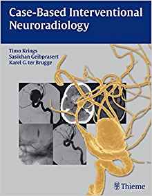 (eBook PDF)Case-based Interventional Neuroradiology by Timo Krings , Sasikhan Geibprasert , Karel ter Brugge 