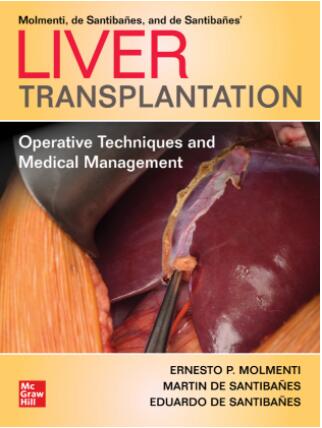 (eBook PDF)Liver Transplantation Operative Techniques and Medical Management by Ernesto P. Molmenti, Martin de Santibañes, Eduardo de Santibañes