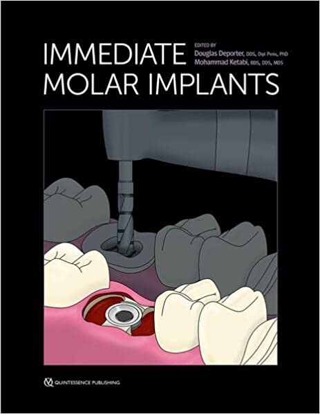 (eBook PDF)Immediate Molar Implants  by Douglas Deporter,Mohammad Ketabi