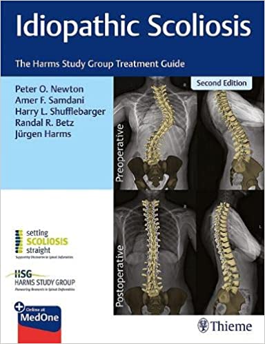 (eBook PDF)Idiopathic Scoliosis The Harms Study Group Treatment Guide 2nd Edition PDF+EPUB by Peter Newton , Amer Samdani , Harry Shufflebarger , Randal Betz , Jürgen Harms 