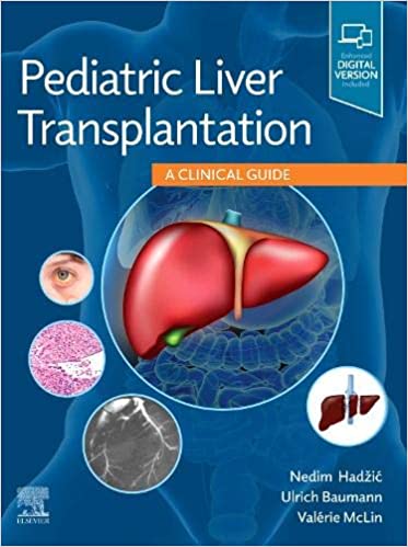 (eBook PDF)Pediatric Liver Transplantation: A Clinical Guide 1st Edition by Nedim Hadzic , Ulrich Baumann, Valérie MCLIN 