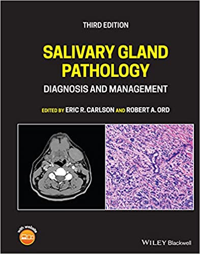 (eBook PDF)Salivary Gland Pathology DIAGNOSIS AND MANAGEMENT 3rd Edition by Eric R. Carlson,Robert A. Ord