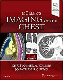 (eBook PDF)Muller's Imaging of the Chest: Expert Radiology Series 2nd Edition by Christopher M. Walker MD , Jonathan Hero Chung MD 