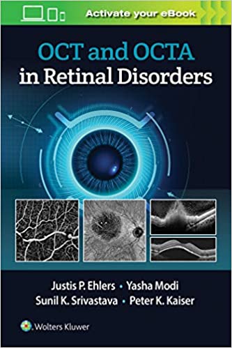 (eBook HTML)OCT and OCTA in Retinal Disorders by Justis P. Ehlers MD 