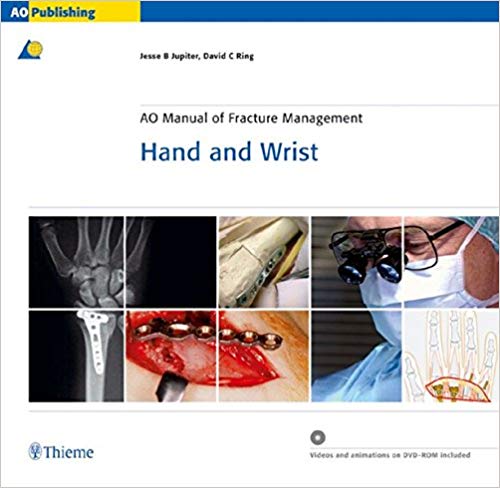 (eBook PDF)AO Manual of Fracture Management - Hand and Wrist by Jesse Jupiter 