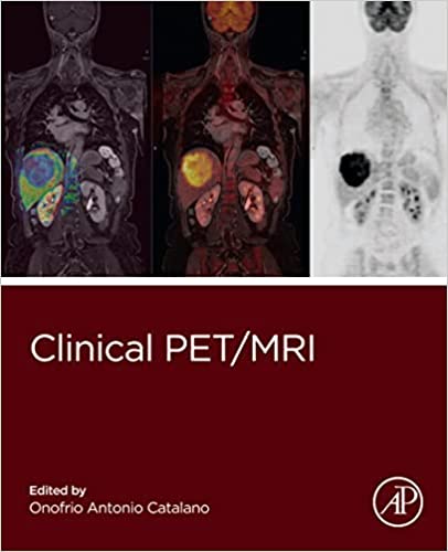 (eBook PDF)Clinical PET/MRI by Onofrio Antonio Catalano