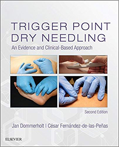 (eBook PDF)Trigger Point Dry Needling 2nd Edition E-Book by Jan Dommerholt , Cesar Fernandez de las Penas , Jan Dommerholt PT DPT MPS , Cesar Fernandez de las Penas PT PhD Dr. SciMed 