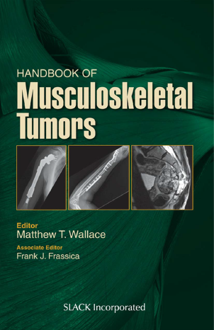 (eBook PDF)Handbook of Musculoskeletal Tumors by Matthew T Wallace MD MBA , Frank J Frassica MD 