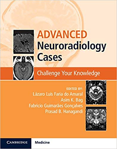 (eBook PDF)Advanced Neuroradiology Cases by Lázaro Luís Faria do Amaral , Asim K. Bag , Fabrício Guimarães Gonçalves , Prasad B. Hanagandi 