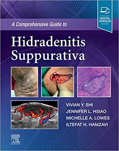 (eBook PDF)A Comprehensive Guide to Hidradenitis Suppurativa - EBook by Vivian Y. Shi , Jennifer L. Hsiao , Michelle Lowes , Iltefat Hamzavi 